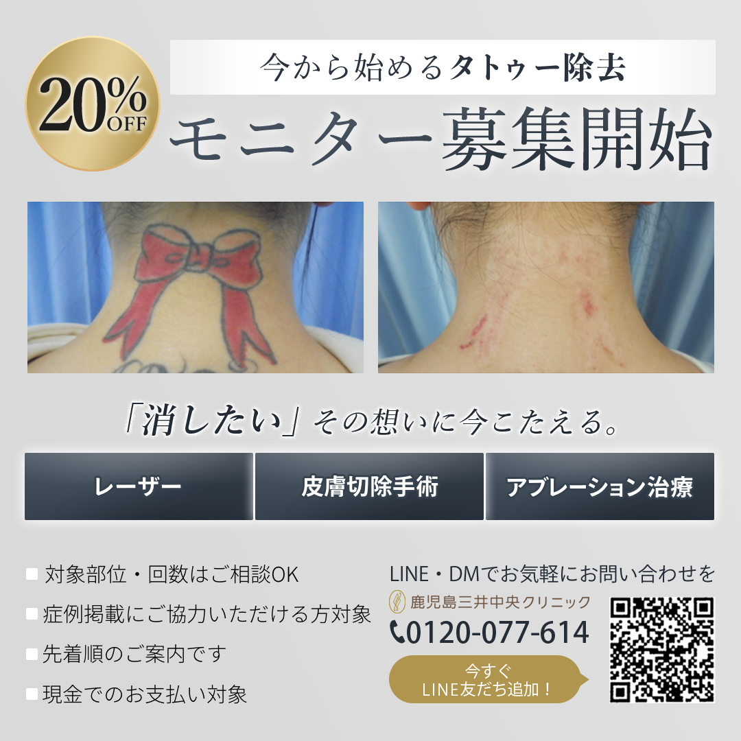 タトゥー